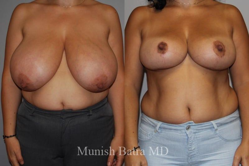 Before and After Image