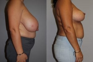 Before and After Image