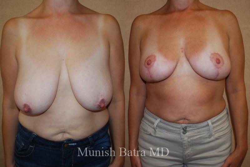 Before and After Image