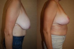 Before and After Image