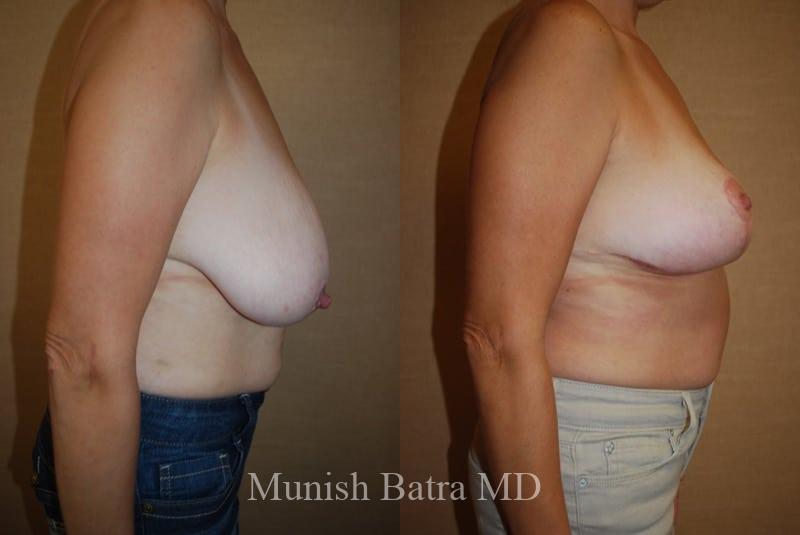 Before and After Image