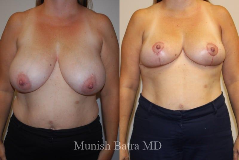 Before and After Image