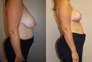 Before and After Image