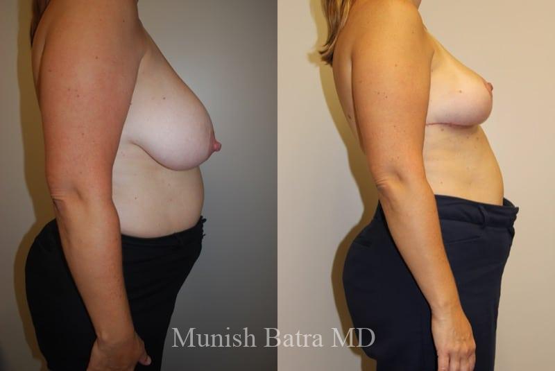 Before and After Image