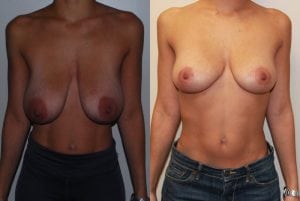 Before and After Image