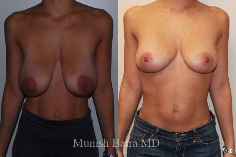 Before and After Image