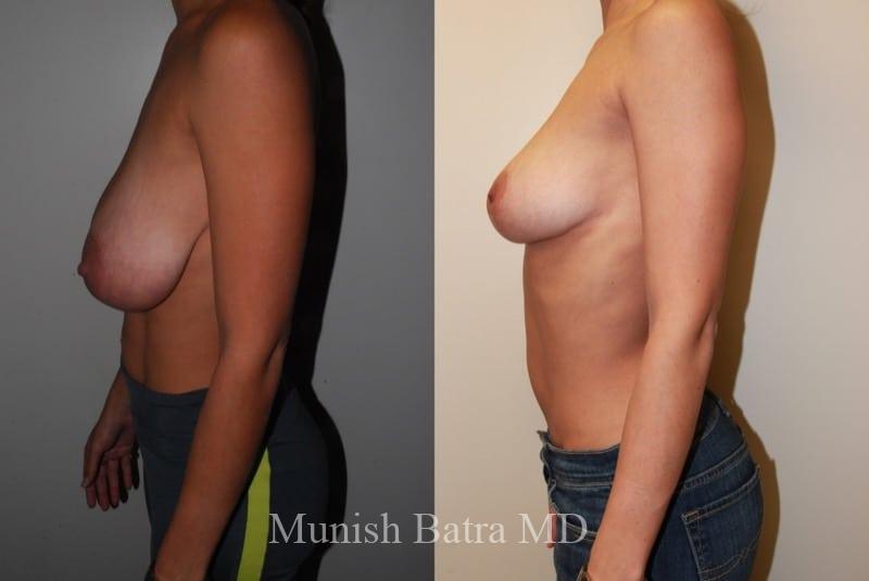 Before and After Image