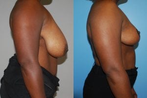 Before and After Image