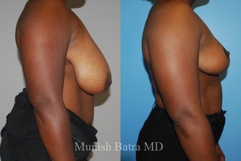 Before and After Image