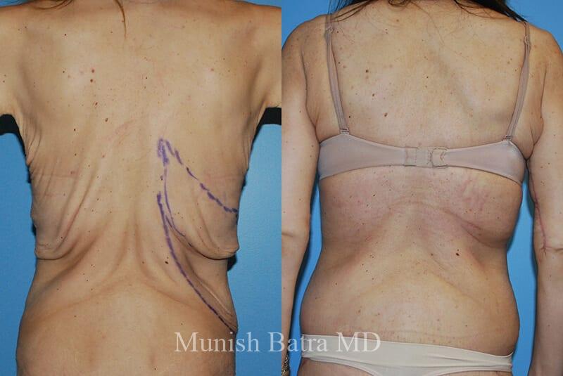 Before and After Image