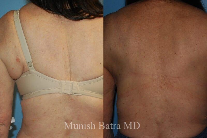 Before and After Image