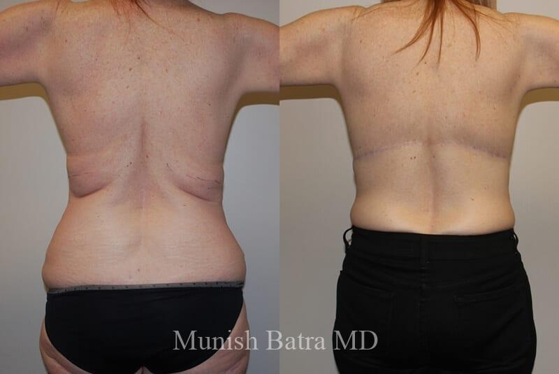 Before and After Image