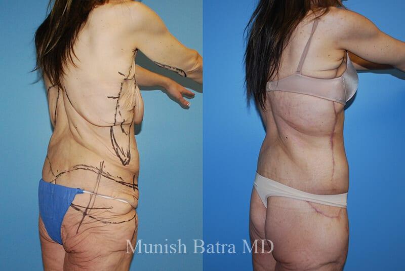 Before and After Image