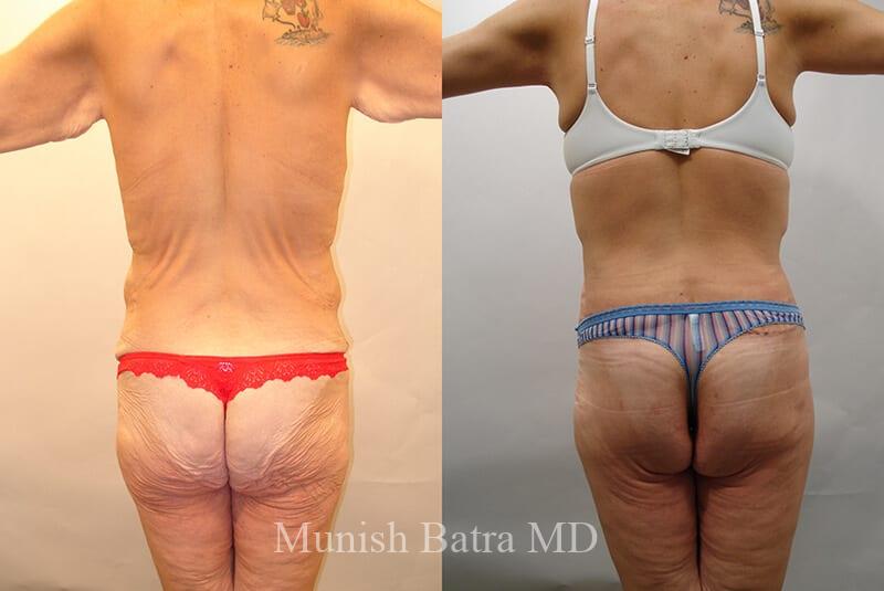 Before and After Image