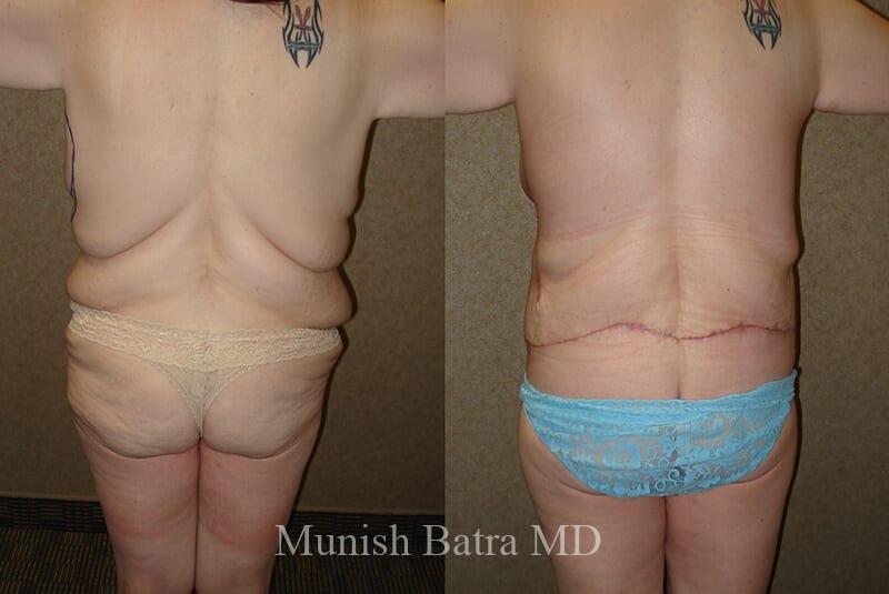 Before and After Image