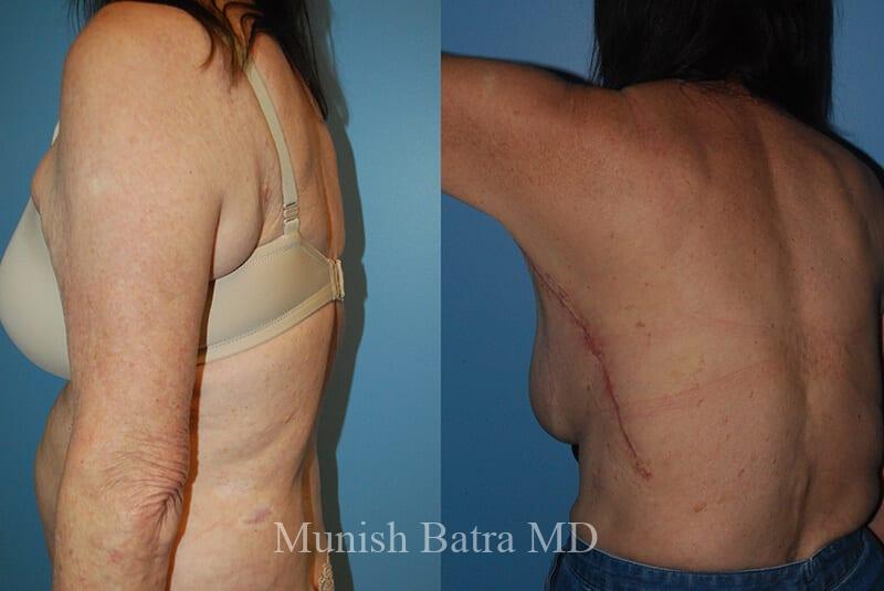 Before and After Image