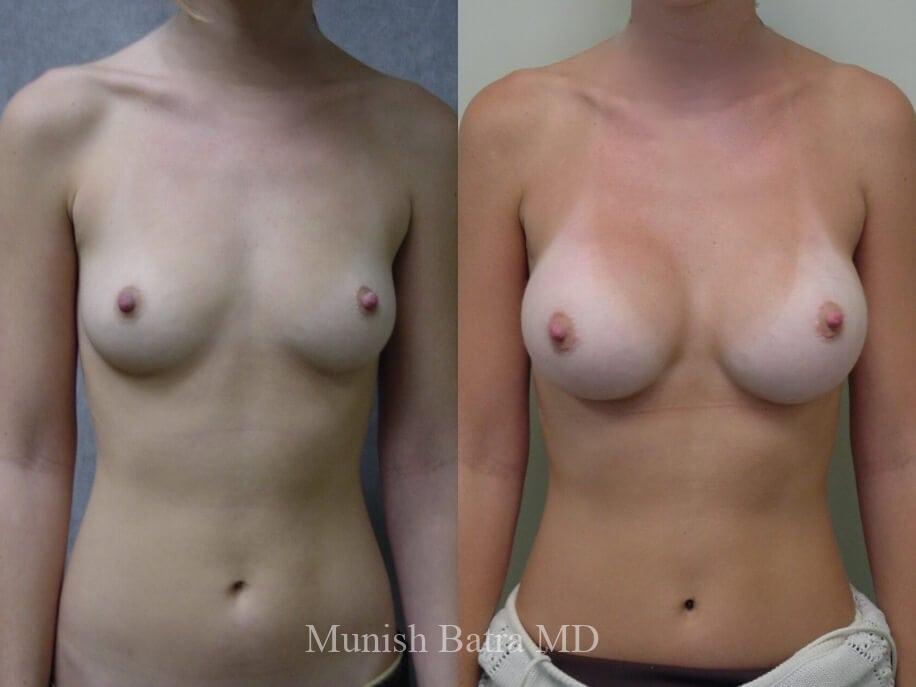 Before and After Image