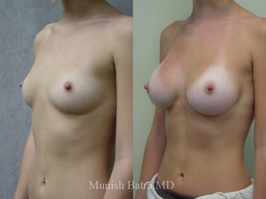 Before and After Image