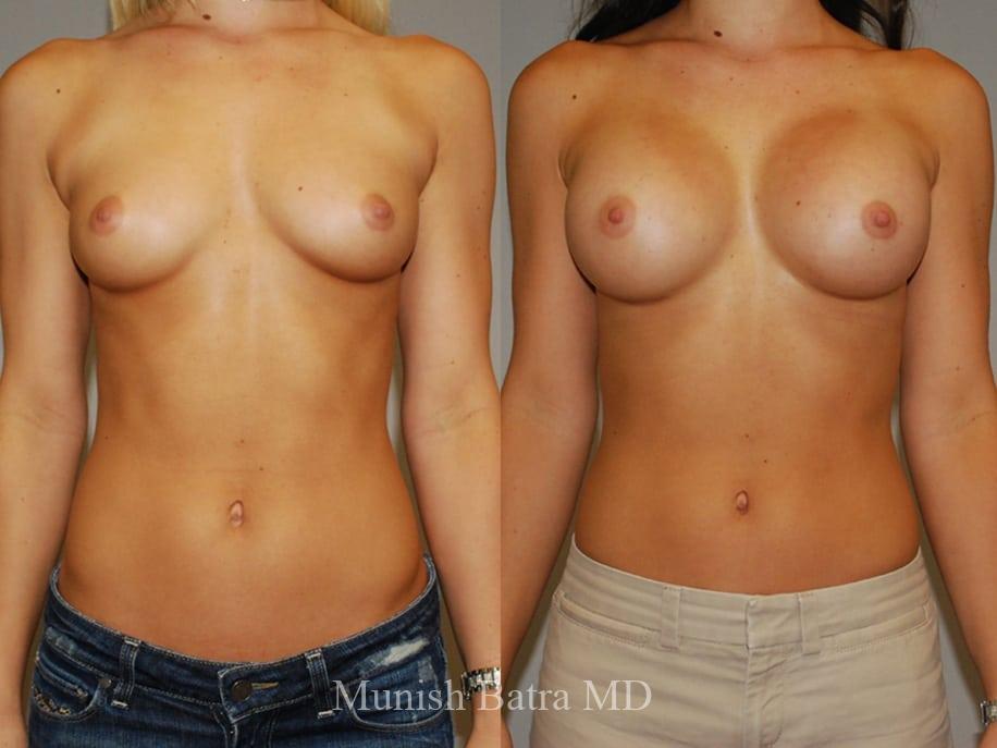Before and After Image