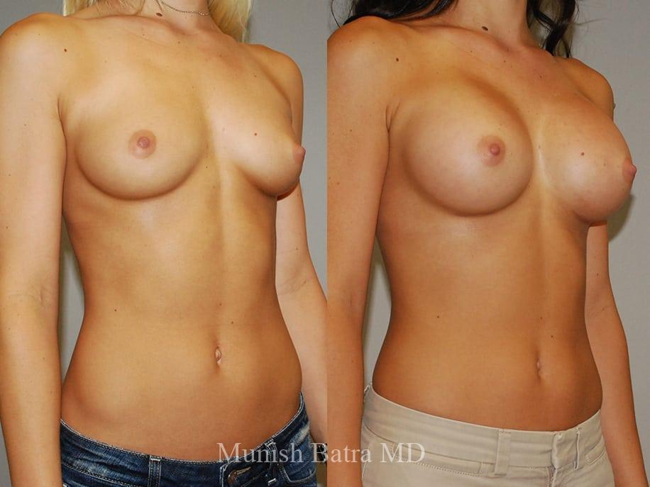 Before and After Image