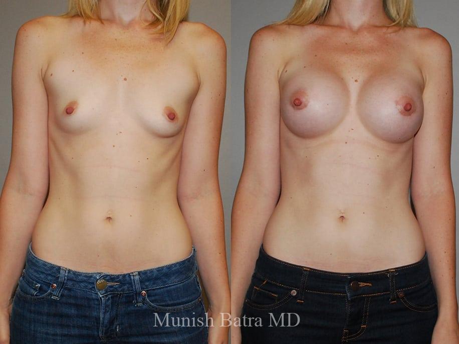 Before and After Image