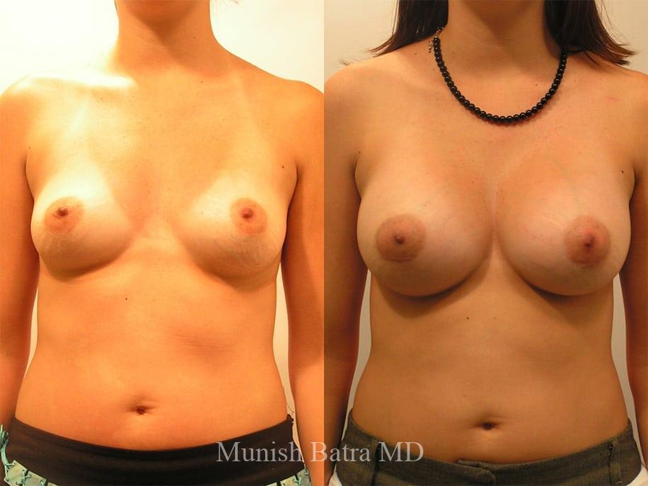 Before and After Image