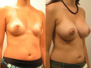 Before and After Image