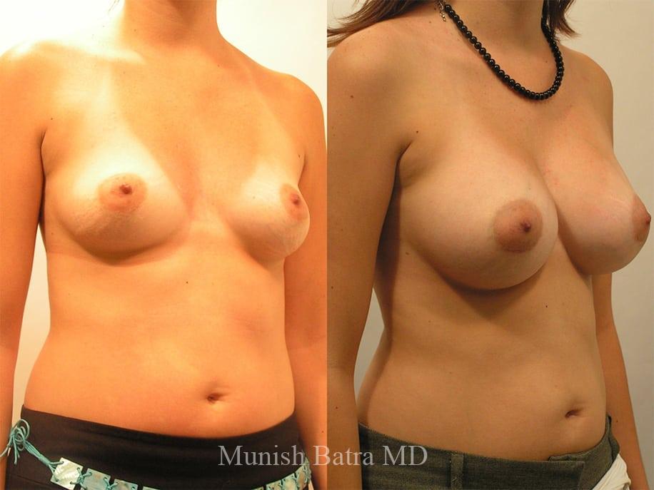 Before and After Image