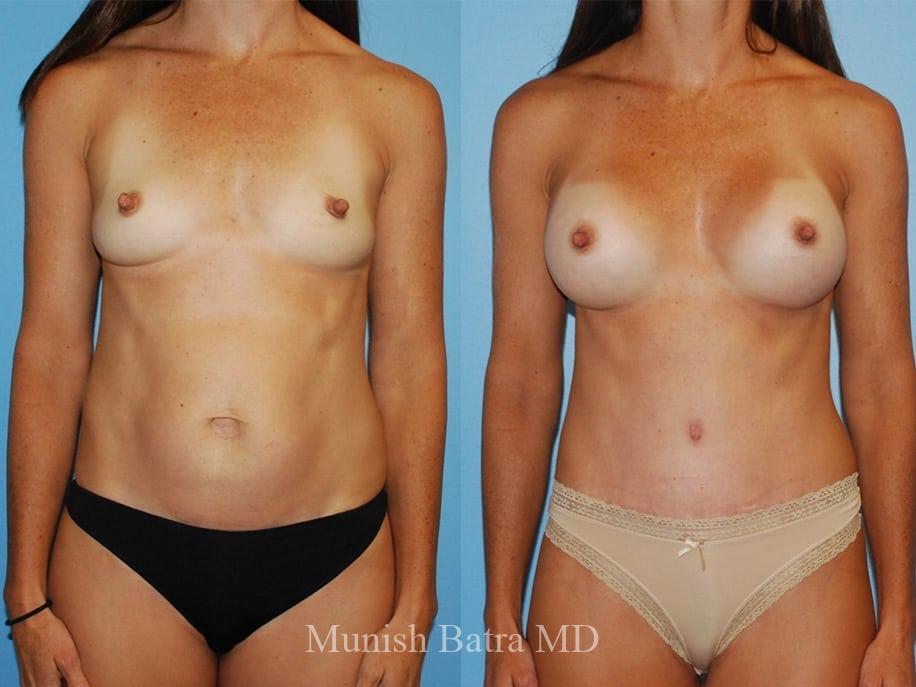 Before and After Image