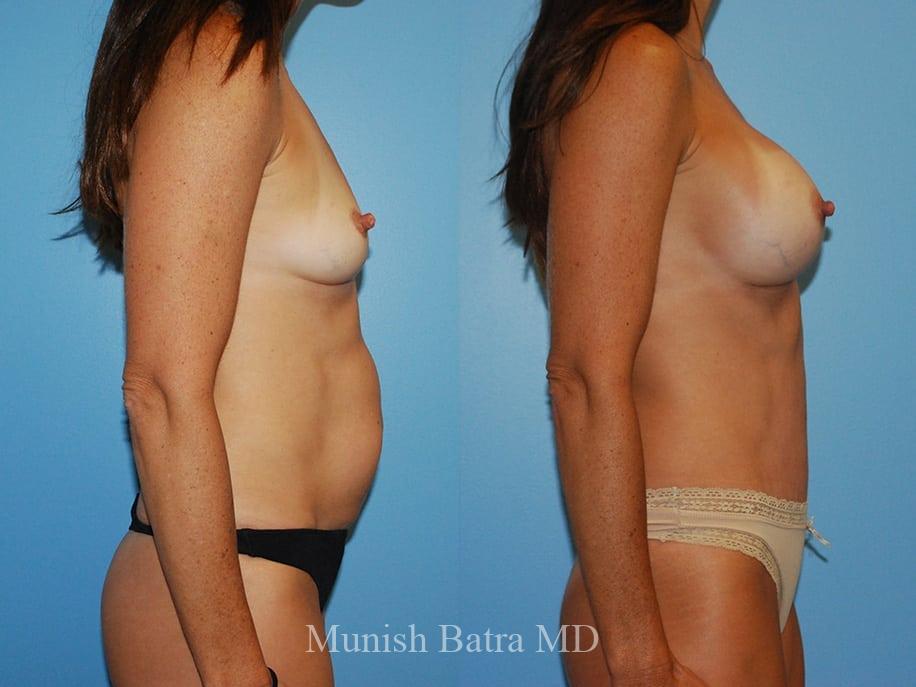 Before and After Image