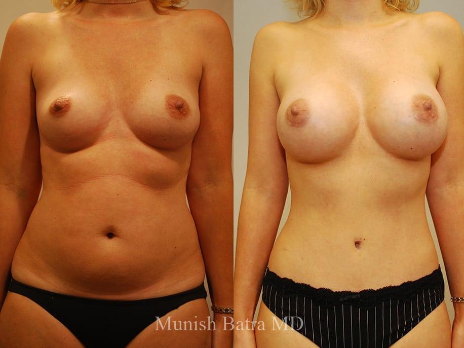 Before and After Image