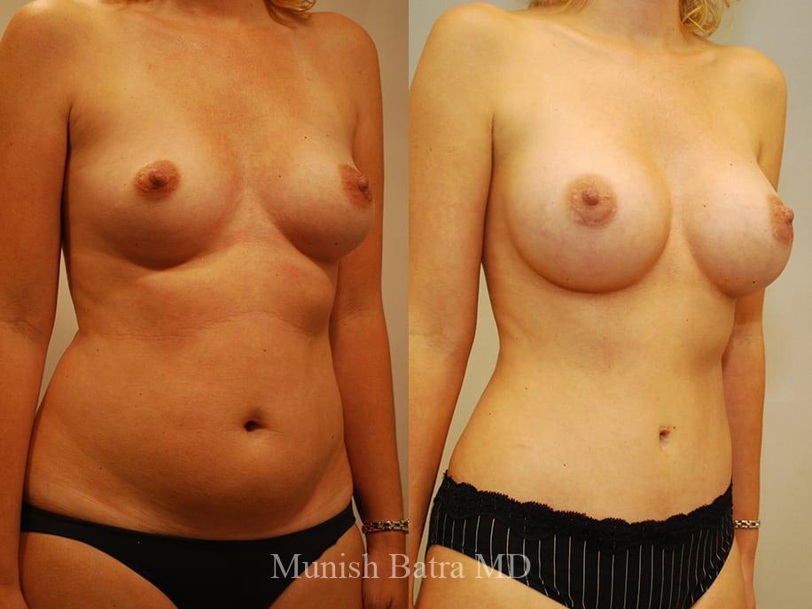 Before and After Image