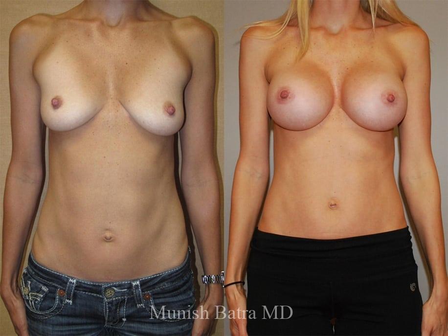 Before and After Image
