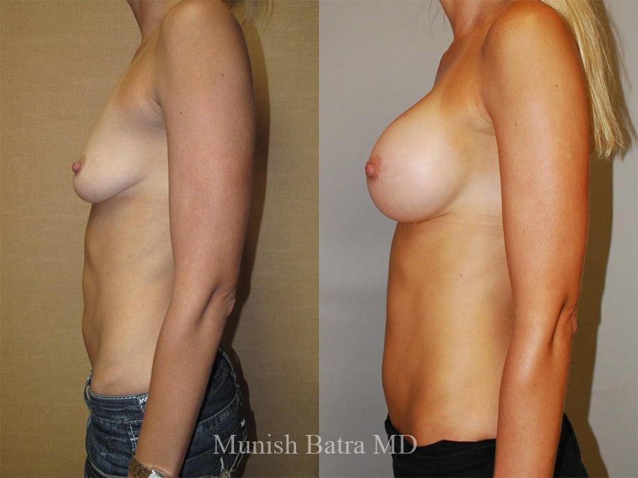 Before and After Image