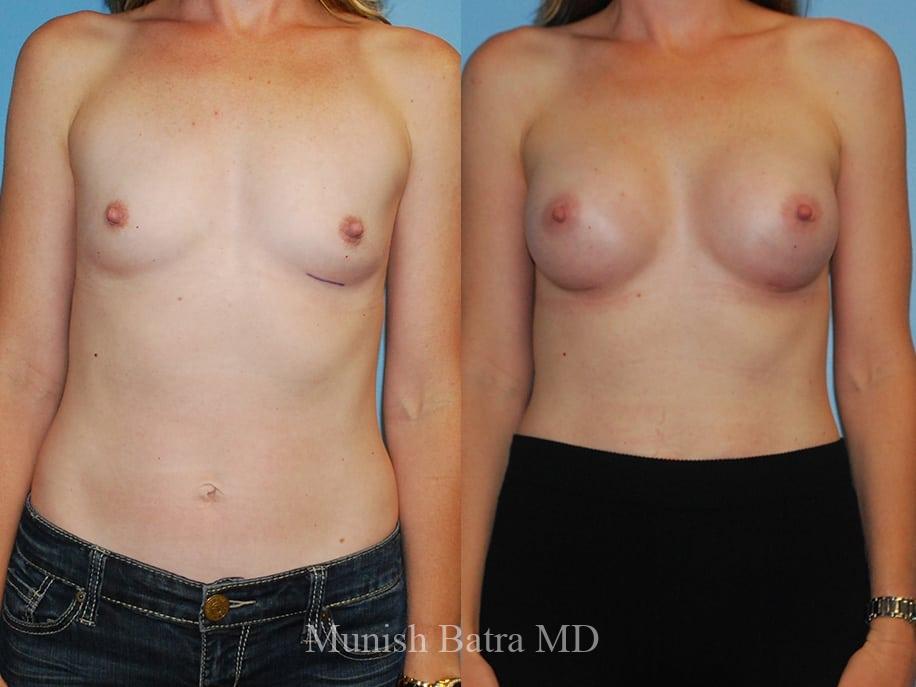 Before and After Image