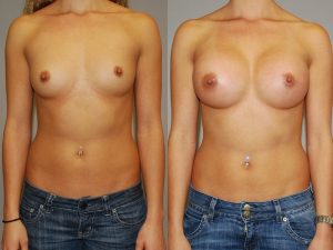 Before and After Image