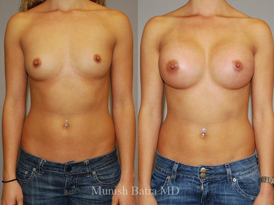 Before and After Image