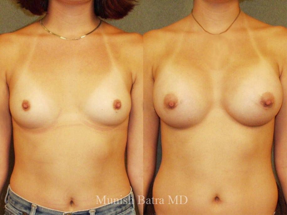 Before and After Image