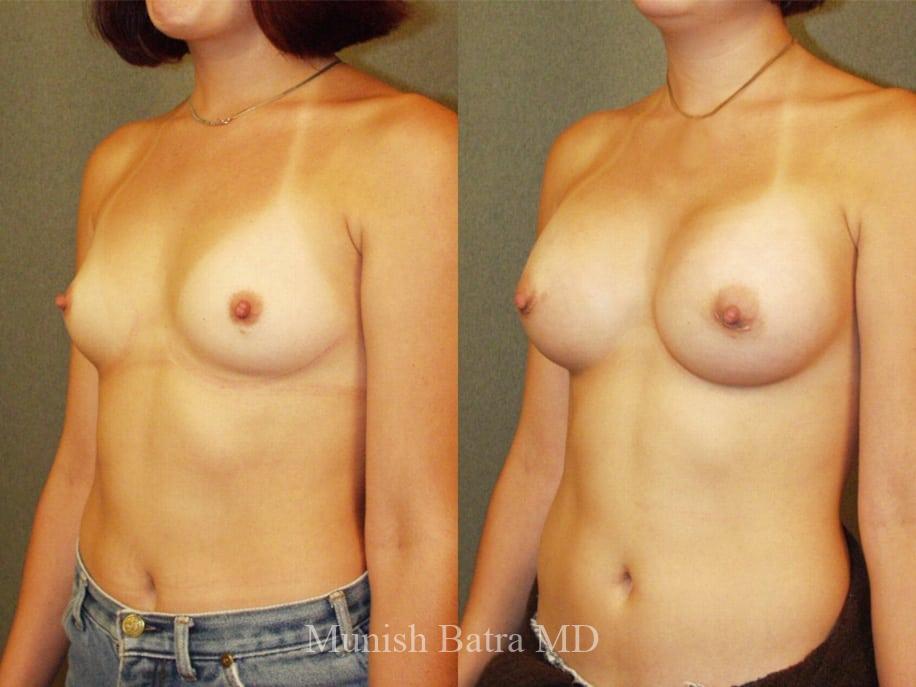 Before and After Image