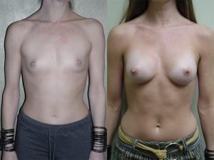 Before and After Image