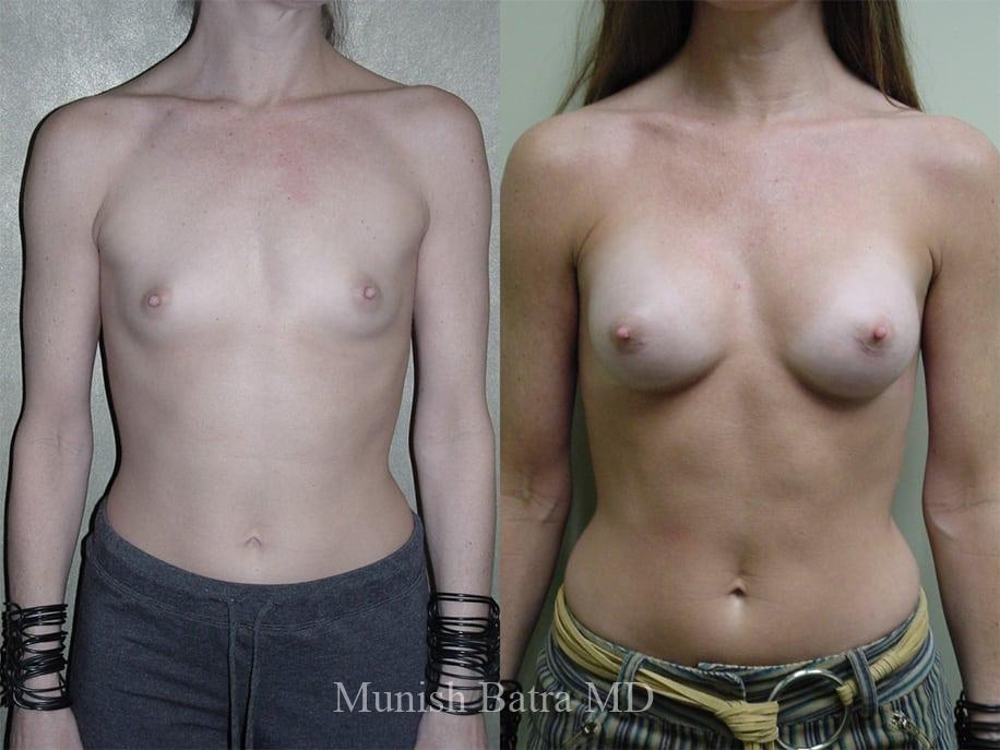 Before and After Image