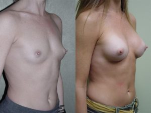 Before and After Image