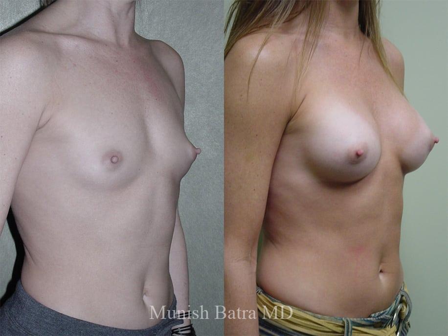 Before and After Image