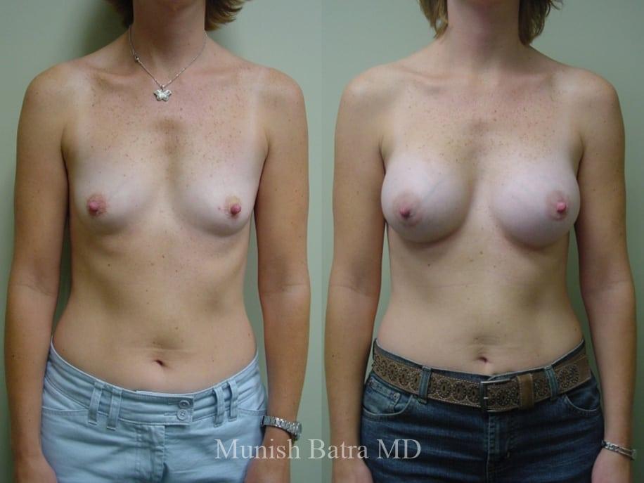 Before and After Image