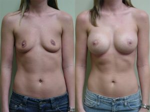 Before and After Image