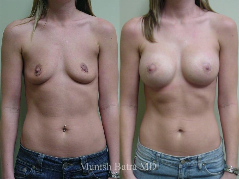 Before and After Image
