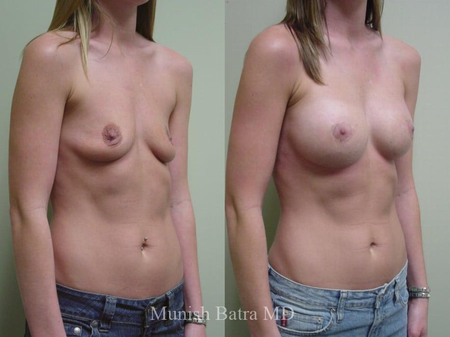 Before and After Image