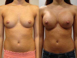 Before and After Image
