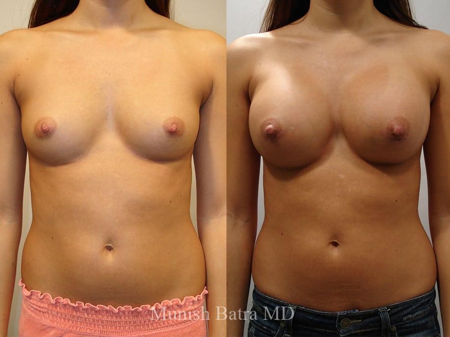 Before and After Image
