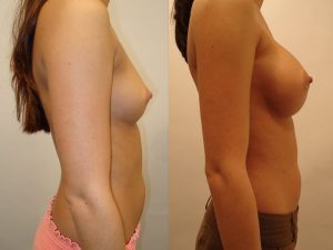 Before and After Image